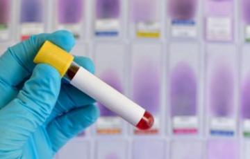 test-coronavirus.jpg