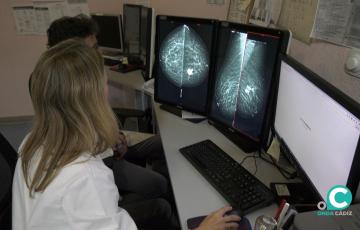 Una profesional sanitaria revisa pruebas de cribado de cáncer de mama. 