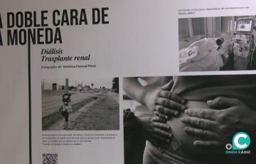 Exposición  ‘La doble cara de la monedad. Diálisis. Trasplante renal’