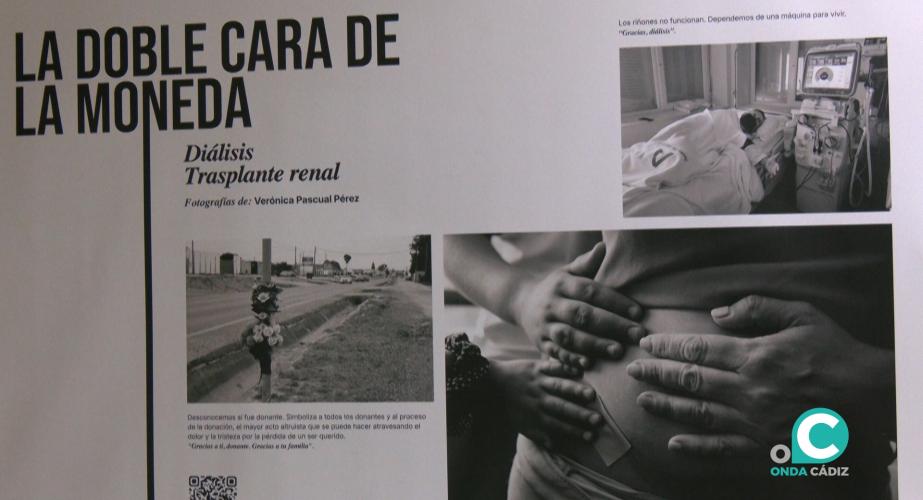 Exposición  ‘La doble cara de la monedad. Diálisis. Trasplante renal’