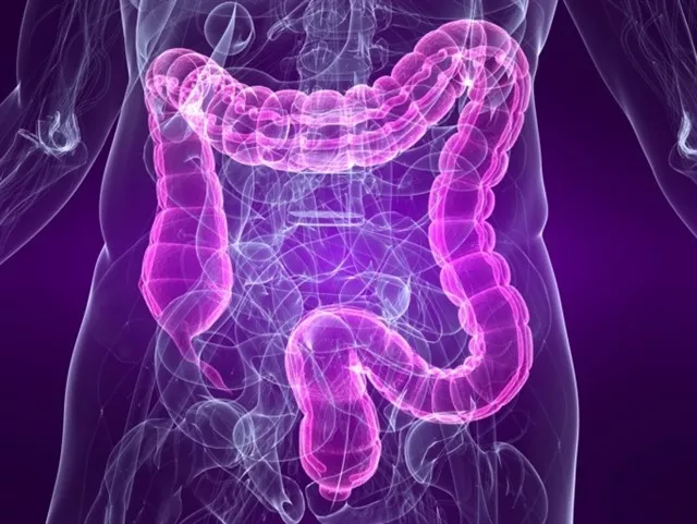noticias cadiz cancer de colon_0.jpg noticias cadiz cancer de colon_0.jpg