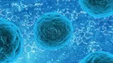 noticias cadiz listeriosis.jpg noticias cadiz listeriosis.jpg