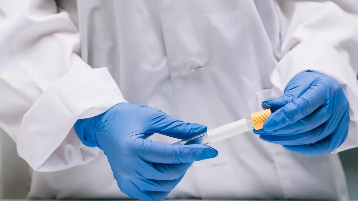 test-coronavirus.jpeg test-coronavirus.jpeg