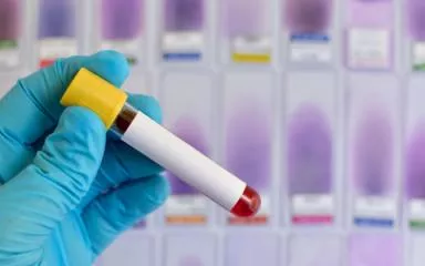 test-coronavirus.jpg test-coronavirus.jpg