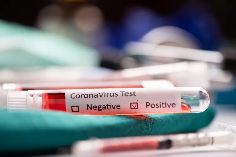 test coronavirus.png test coronavirus.png