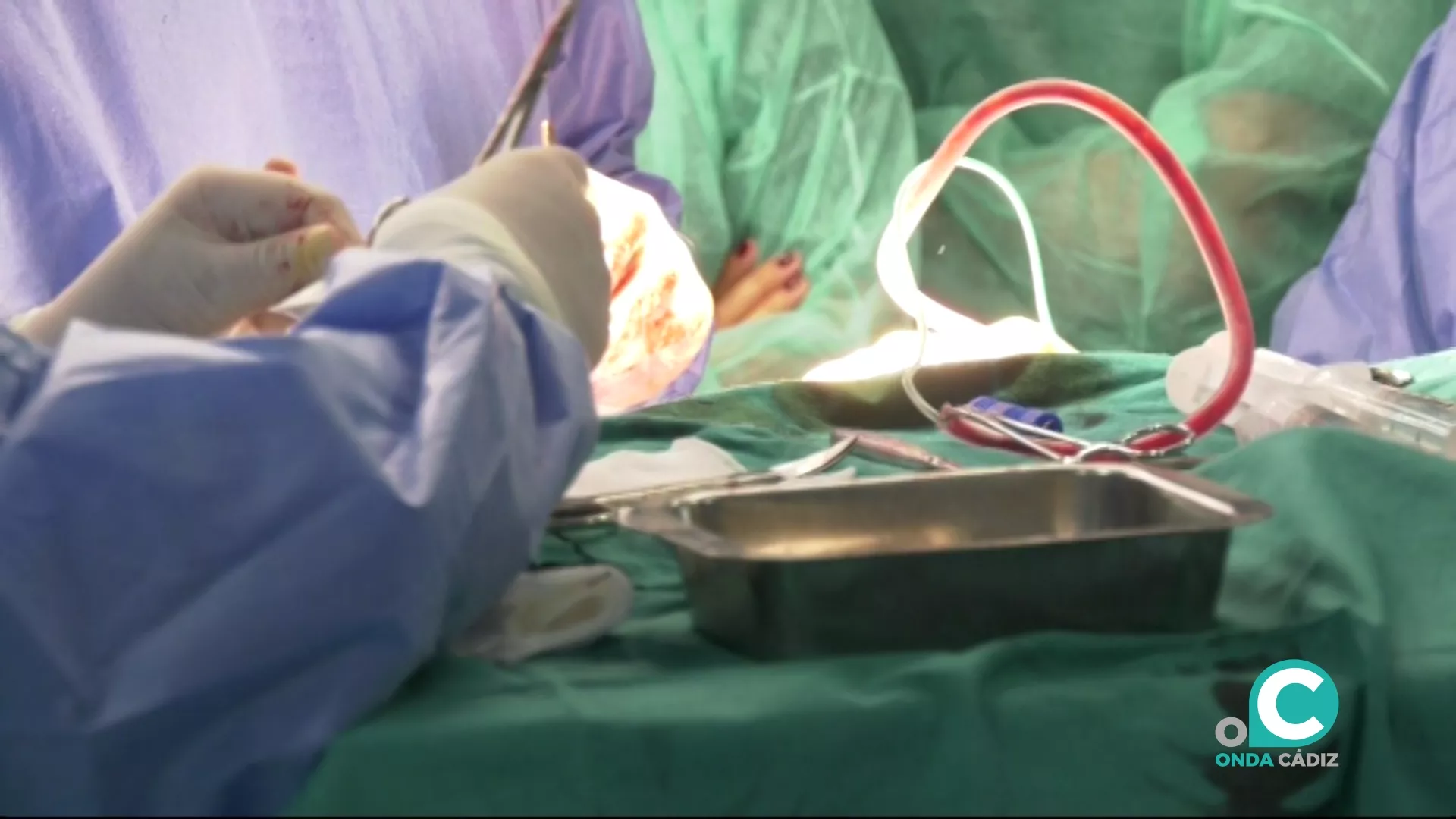 En lo que va de año, hasta el mes de abril, se han producido 36 trasplantes renales en el Hospital Puerta del Mar