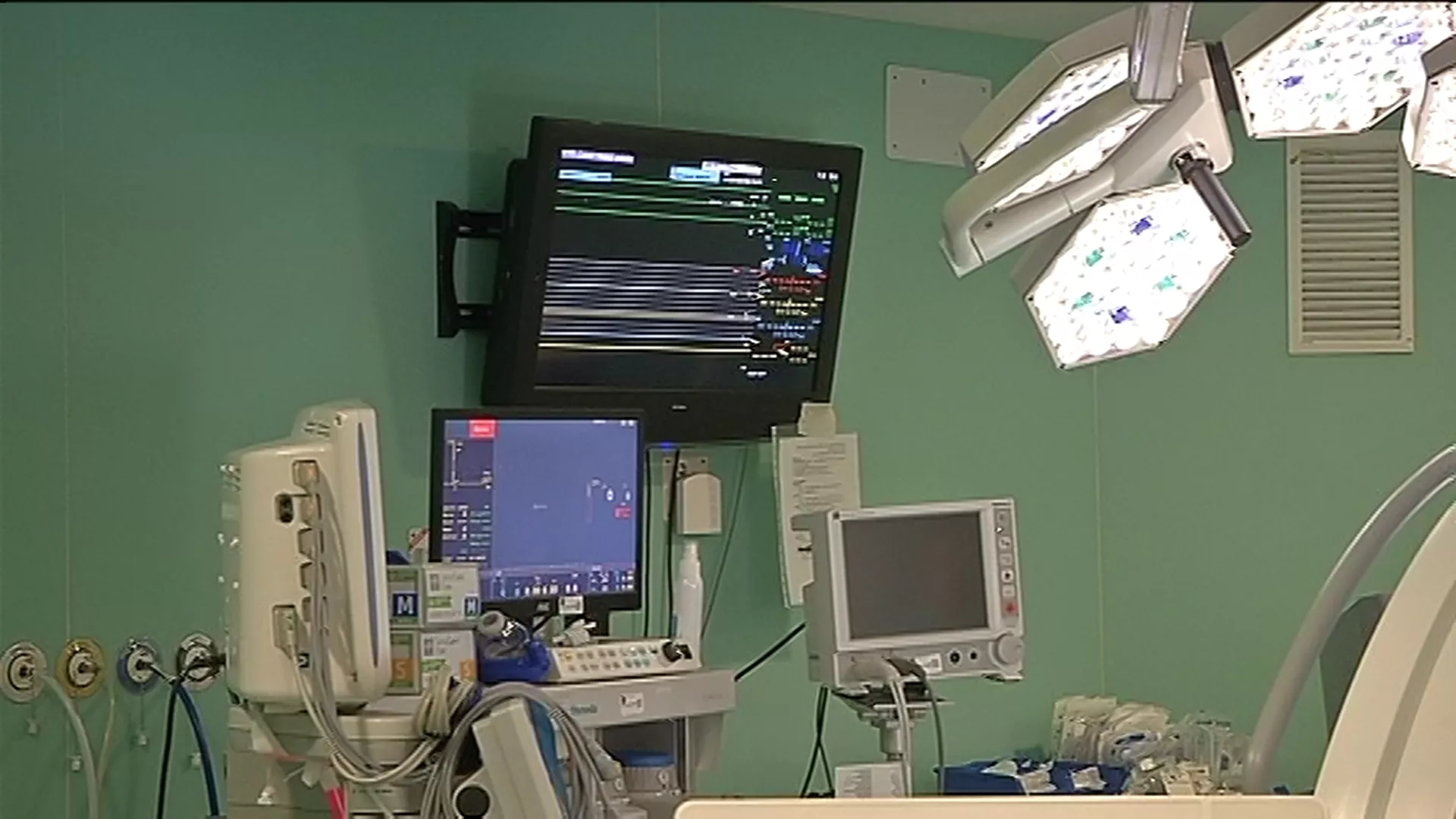 El hospital Puerta del Mar alcanza las 50 trombectomías 