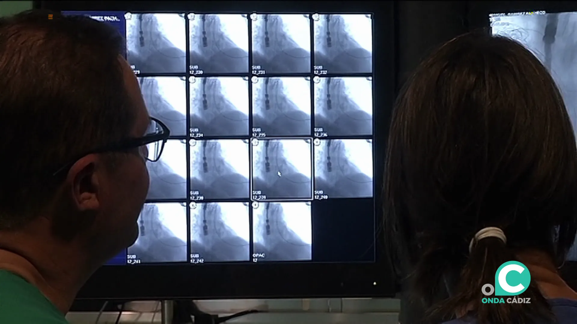 El riesgo de padecer cáncer de pulmón se cuadruplica con el consumo de cigarrillos El riesgo de padecer cáncer de pulmón se cuadruplica con el consumo de cigarrillos