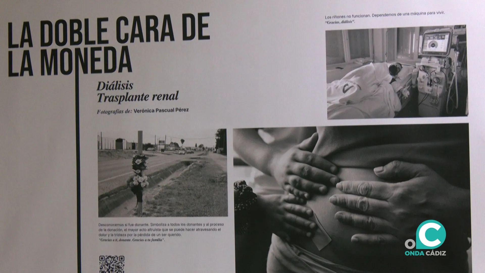 Exposición  ‘La doble cara de la monedad. Diálisis. Trasplante renal’